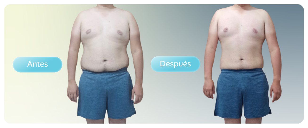 Antes y después de un paciente del programa de control de peso de Optimum