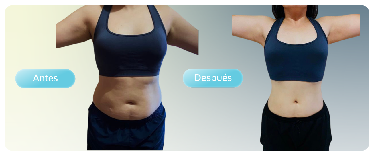 Antes y después de una paciente del programa de nutrición de Optimum